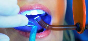 Современная стоматология и полимеры: вчера, сегодня, завтра