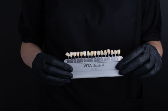 Современная стоматология предлагает множество способов улучшения внешнего вида улыбки, среди которых виниры занимают особое место. Эти тонкие накладки способны кардинально преобразить зубной ряд, исправив множество эстетических недостатков. Однако перед принятием решения об установке виниров важно объективно оценить все их преимущества и недостатки, понять механизм воздействия на зубы и осознать долгосрочные последствия такого протезирования.